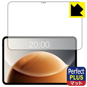 Perfect Shield Plusy ˒ጸ zیtB Teclast T65 { А