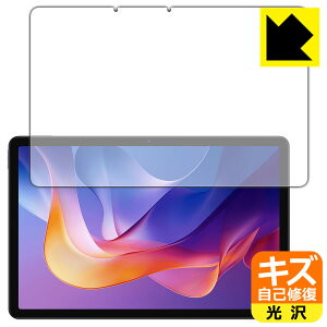 LYȏCیtB Xiaomi Redmi Pad 2 / Redmi Pad 2 4G / Redmi Pad 2 Play Bundle (ʗp) { А