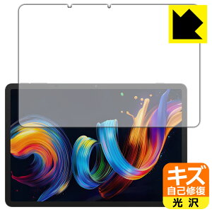 LYȏCیtB TCL NXTPAPER 11 Plus (ʗp) { А