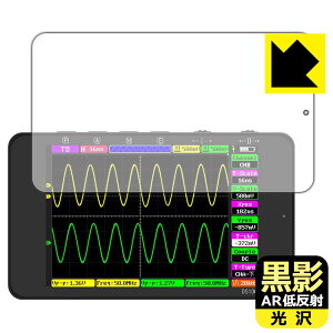 ey ARᔽˁE zیtB ALIENTEK DS100 IVXR[v { А