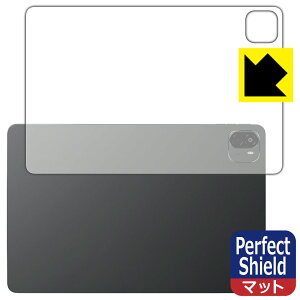 Perfect Shieldy ˒ጸ zیtB ALLDOCUBE Ultra Pad (wʗp) { А