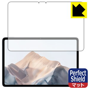 Perfect Shield�y ���˒ጸ �z�ی�t�B���� nubia Pad Pro ���{�� ���А�������