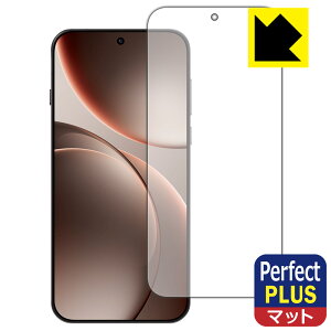 Perfect Shield Plusy ˒ጸ zیtB OPPO Find X9 Pro y wFؑΉ z { А
