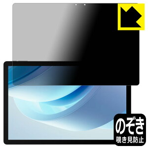 Privacy Shield�y �`�����h�~�E���˒ጸ �z�ی�t�B���� DOOGEE U13 ���{�� ���А�������