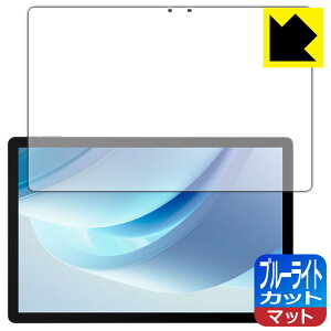 �u���[���C�g�J�b�g�y ���˒ጸ �z�ی�t�B���� DOOGEE U13 ���{�� ���А�������