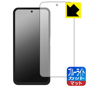 �u���[���C�g�J�b�g�y ���˒ጸ �z�ی�t�B���� Xiaomi REDMI 15 5G �y �����P�[�X�Ή��� �z ���{�� ���А�������