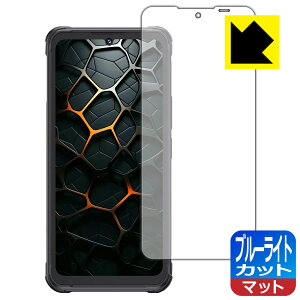 �u���[���C�g�J�b�g�y ���˒ጸ �z�ی�t�B���� CUBOT KingKong Ace 5 ���{�� ���А�������
