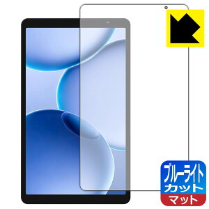 �u���[���C�g�J�b�g�y ���˒ጸ �z�ی�t�B���� PHILIPS T7335 ���{�� ���А�������