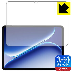 �u���[���C�g�J�b�g�y ���˒ጸ �z�ی�t�B���� OnePlus Pad Go 2 ���{�� ���А�������