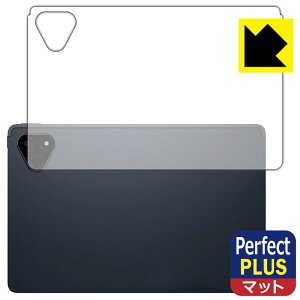 Perfect Shield Plus�y ���˒ጸ �z�ی�t�B���� ALLDOCUBE iPlay 70E (2026) T1161 (�w�ʗp) ���{�� ���А�������