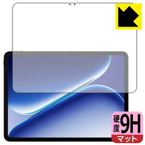 9H���d�x�y ���˒ጸ �z�ی�t�B���� OnePlus Pad Go 2 (��ʗp) ���{�� ���А�������