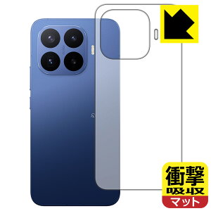 �Ռ��z���y ���˒ጸ �z�ی�t�B���� Xiaomi 17T Pro (�w�ʗp) ���{�� ���А�������