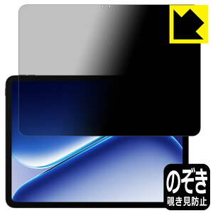 Privacy Shield�y �`�����h�~�E���˒ጸ �z�ی�t�B���� OnePlus Pad Go 2 ���{�� ���А�������