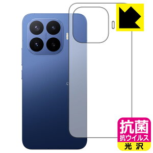 �R�� �R�E�C���X�y ���� �z�ی�t�B���� Xiaomi 17T Pro (�w�ʗp) ���{�� ���А�������