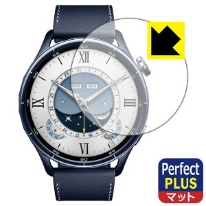 Perfect Shield Plus�y ���˒ጸ �z�ی�t�B���� Xiaomi Watch S5 �y �P�[�X�T�C�Y 46mm�p �z ���{�� ���А�������
