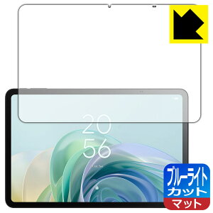 �u���[���C�g�J�b�g�y ���˒ጸ �z�ی�t�B���� TCL TAB 11 Gen 2 (9465X5) ���{�� ���А�������