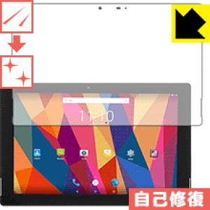 �L�Y���ȏC���ی�t�B���� T-bao X101A ���{�� ���А�������