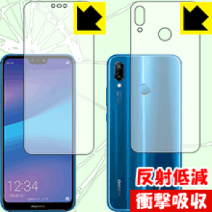 Ռzy ˒ጸ zیtB t@[EFC HUAWEI P20 lite (ʃZbg) { А