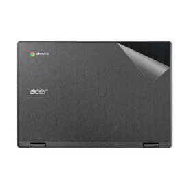 スキンシール Acer Chromebook 311 【透明・すりガラス調】