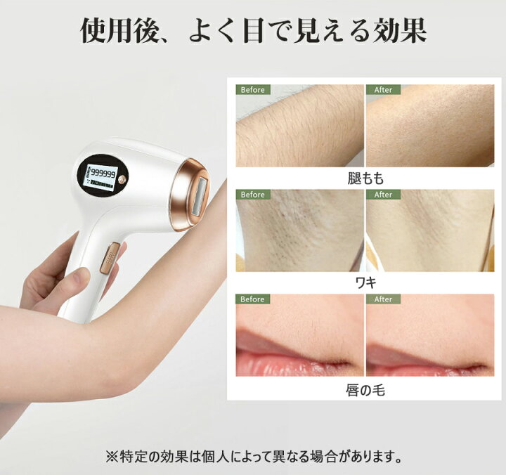楽天市場】脱毛器 99万発照射 フラッシュ脱毛器 光美容器 VIO脱毛 IPL 