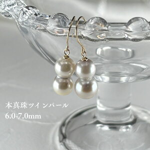 AR^ cCp[sAX CO 6-7mm K18YG K14WG tbN i`O[ p[CO SVS[hH _{򌣕i {^ F oq oq^ oqp[ cC c