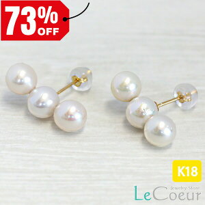 lC K18 p[ sAX AM[Ή 3A AM[  Ă΂ { tH[} O ^ 嗱 3 IP[W 傫 o[ X^bh  Y 18  1yA 