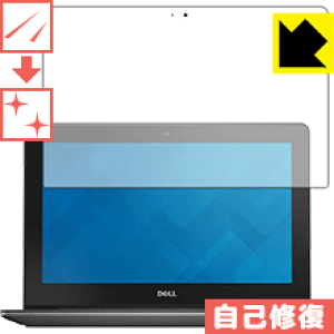 �L�Y���ȏC���ی�t�B���� Dell Chromebook 11 ���{�� ���А�������