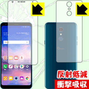 Ռzy ˒ጸ zیtB LG Q Stylus (LM-Q710XM) (ʃZbg) { А