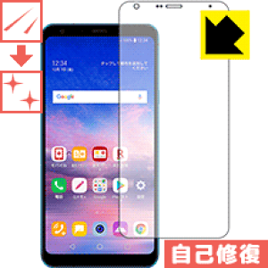 LYȏCیtB LG Q Stylus (LM-Q710XM) (Oʂ̂) { А