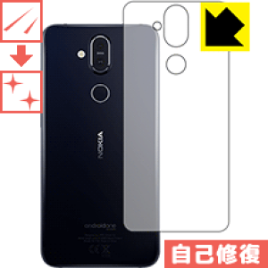 �L�Y���ȏC���ی�t�B���� Nokia 8.1 (�w�ʂ̂�) ���{�� ���А�������