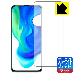 u[CgJbgy ˒ጸ zیtB Xiaomi POCO F2 Pro y wFؑΉ z { А