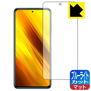 u[CgJbgy ˒ጸ zیtB Xiaomi POCO X3 NFC { А