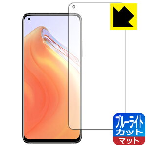 u[CgJbgy ˒ጸ zیtB Xiaomi Mi 10T 5G / Mi 10T Pro 5G { А