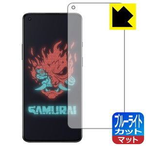 u[CgJbgy ˒ጸ zیtB OnePlus 8T Cyberpunk 2077 Limited Edition y wFؑΉ z { А