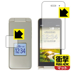 Ռzy ˒ጸ zیtB 񂽂P[^C KYF41 / 񂽂P[^C Cg KYF43 (CpETup) { А