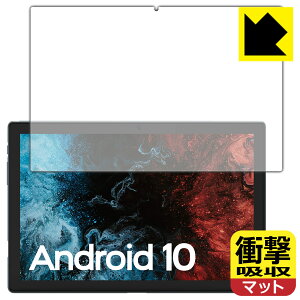 �Ռ��z���y ���˒ጸ �z�ی�t�B���� VASTKING KingPad K10 / K10 Pro ���{�� ���А�������