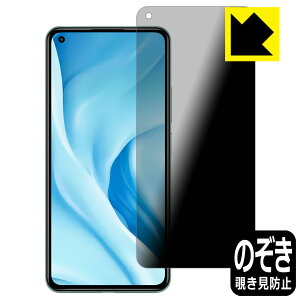 Privacy Shieldy `h~E˒ጸ zیtB Xiaomi Mi 11 Lite 5G { А