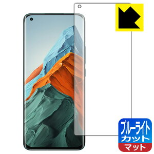 u[CgJbgy ˒ጸ zیtB Xiaomi Mi 11 Pro y wFؑΉ z { А