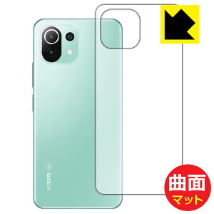 Flexible Shield Mattey ˒ጸ zیtB Xiaomi Mi 11 Lite 5G (wʂ̂) { А