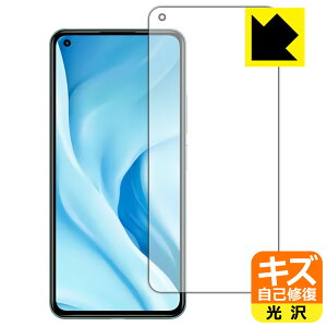 LYȏCیtB Xiaomi Mi 11 Lite 5G (Oʂ̂) { А