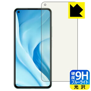 9Hdxy u[CgJbg zیtB Xiaomi Mi 11 Lite 5G { А