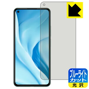 u[CgJbgy  zیtB Xiaomi Mi 11 Lite 5G { А