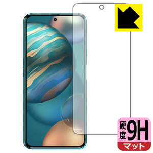 9H���d�x�y ���˒ጸ �z�ی�t�B���� CUBOT X50 (�O�ʂ̂�) ���{�� ���А�������