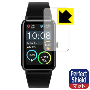 Perfect Shield STSEETOP �X�}�[�g�E�H�b�` TRU-01 / ZX18 (3���Z�b�g) ���{�� ���А�������