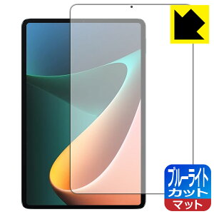�u���[���C�g�J�b�g�y ���˒ጸ �z�ی�t�B���� Xiaomi Pad 5 11 / Xiaomi Pad 5 Pro 11 ���{�� ���А�������