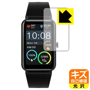 �L�Y���ȏC���ی�t�B���� STSEETOP �X�}�[�g�E�H�b�` TRU-01 / ZX18 ���{�� ���А�������