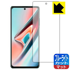 �u���[���C�g�J�b�g�y ���˒ጸ �z�ی�t�B���� Blackview A100 ���{�� ���А�������