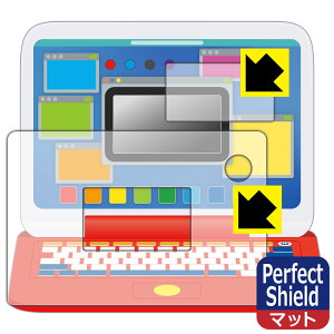 Perfect Shield |P sJbƃAJf~[ }EXŃQbgp\R p tیtB (ʗp/ӂp 2g) { А