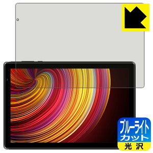 �u���[���C�g�J�b�g�y ���� �z�ی�t�B���� IRIE 10.1�C���`�^�u���b�g FFF-TAB10A2 ���{�� ���А�������