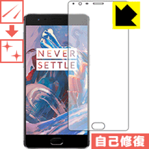 LYȏCیtB OnePlus 3 / 3T { А